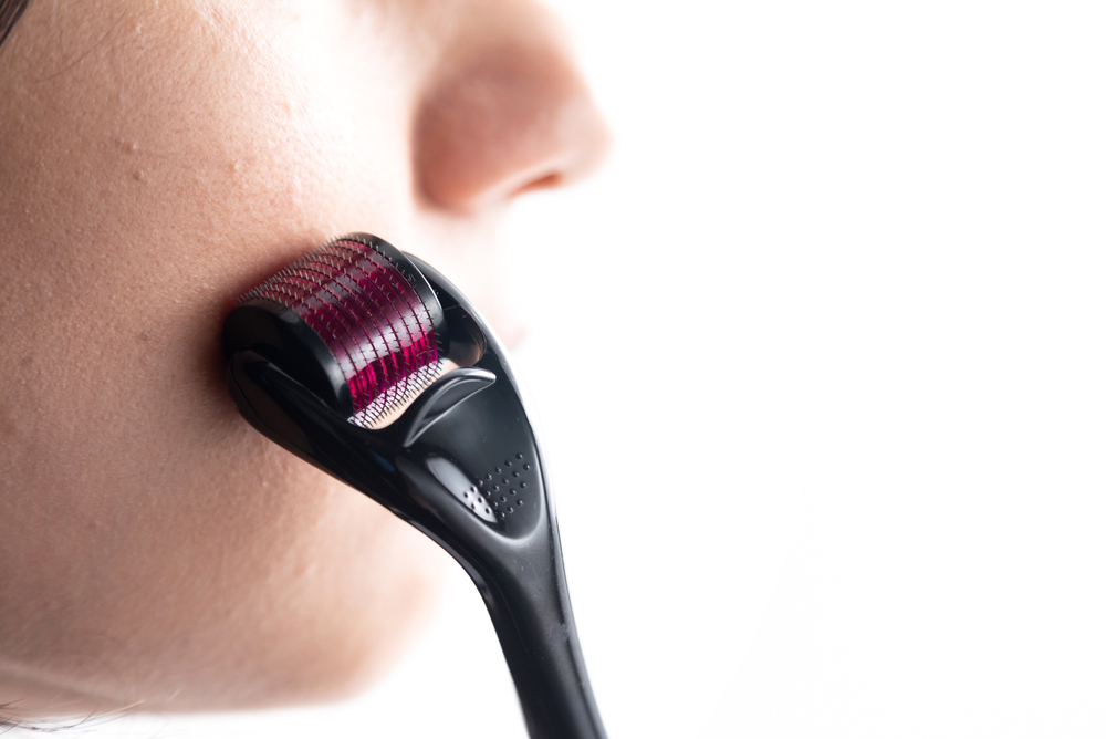 application,of,dermaroller,on,the,face,by,a,women,on